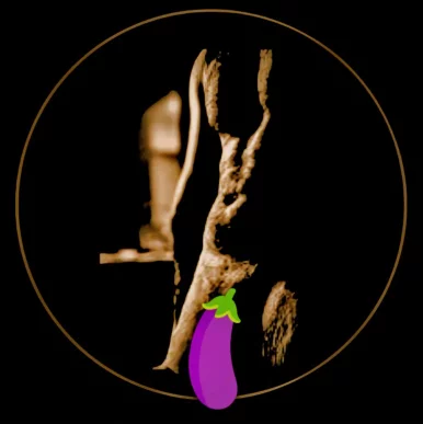 Photo of model @bananaflasher