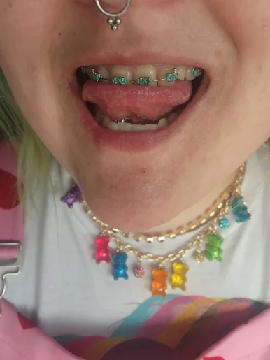 Photo of model @bracefacexo