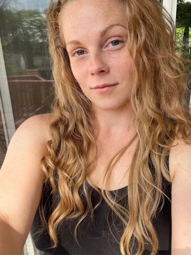 Photo of model @empoweredamputeefreepage